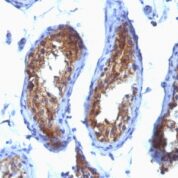 FFPE human testicular carcinoma sections stained with 100 ul anti-Major Vault Protein (clone SPM280) at 1:300. HIER epitope retrieval prior to staining was performed in 10mM Tris 1mM EDTA, pH 9.0.